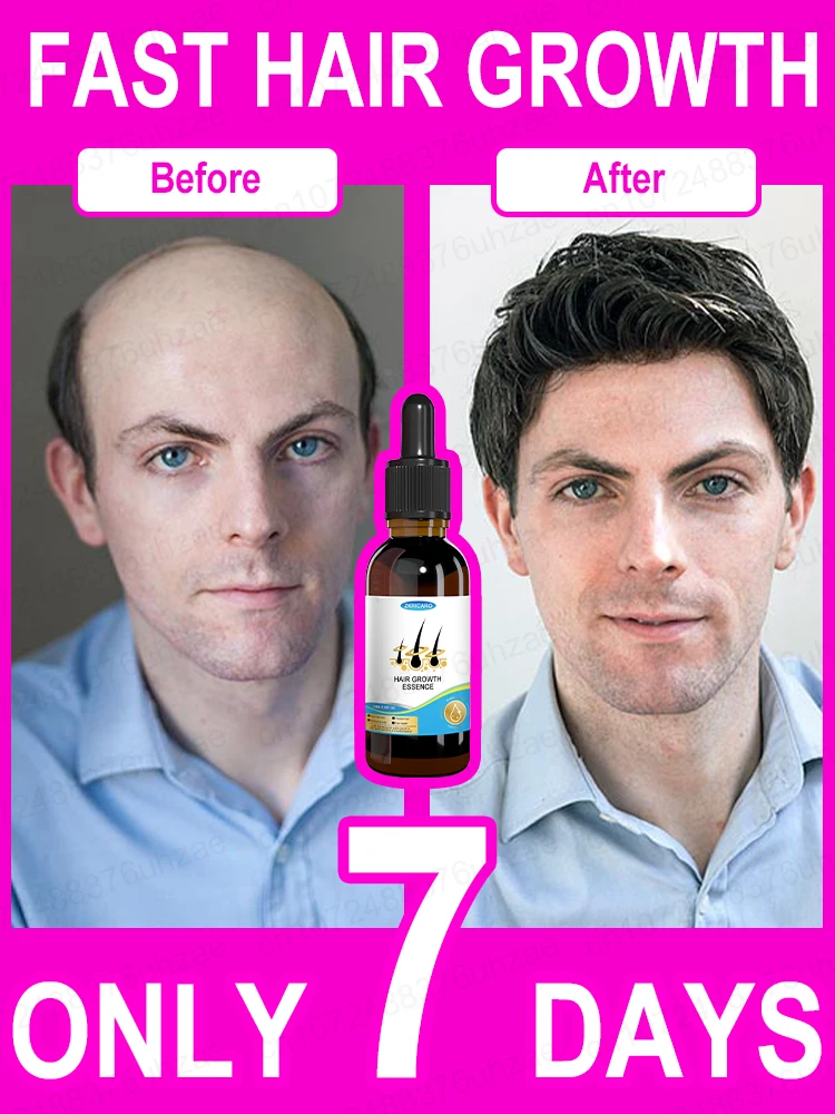 Hair Increasing Serum