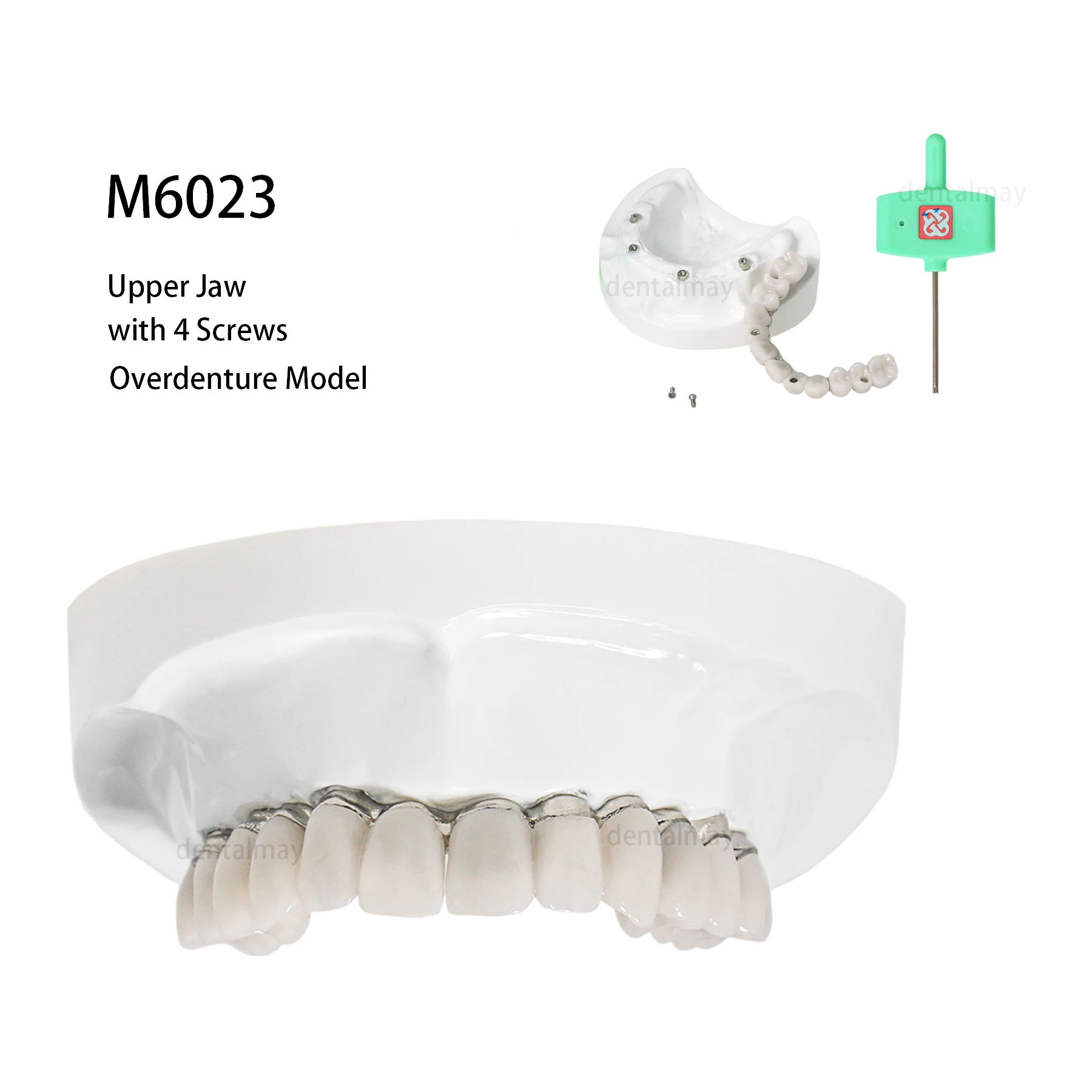 

Dental Teeth Model Overdenture Model Upper Jaw Implant All-on-4 Restoration with 4 Screws M6023