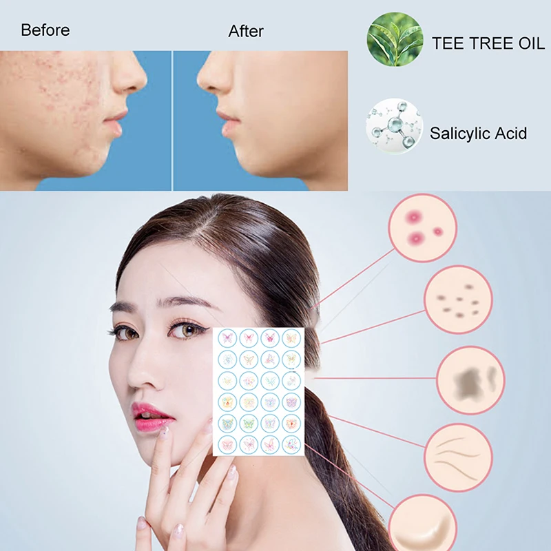 96pcs Vlinder Onzichtbare Acne Patch Verminderen Puistjes Mee-eters Milde Niet-irriterende Concealer Gezicht Spot Huidverzorging Gereedschap Waterproo