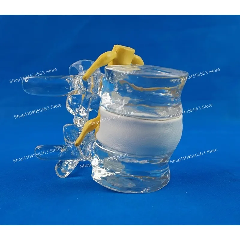 فتق القرص بثق العمود الفقري والعمود الفقري ، نموذج عرض القرص القطني ، نموذج العمود الفقري القطني منتج جديد #4