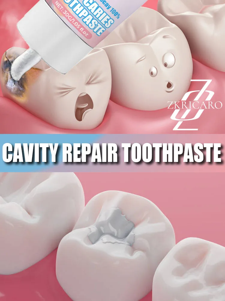 Anti-Cavity Toothpaste Tooth Remineralization Recovery Enamel Repair Strengthening Restoration Decay Protection Dental Teeth