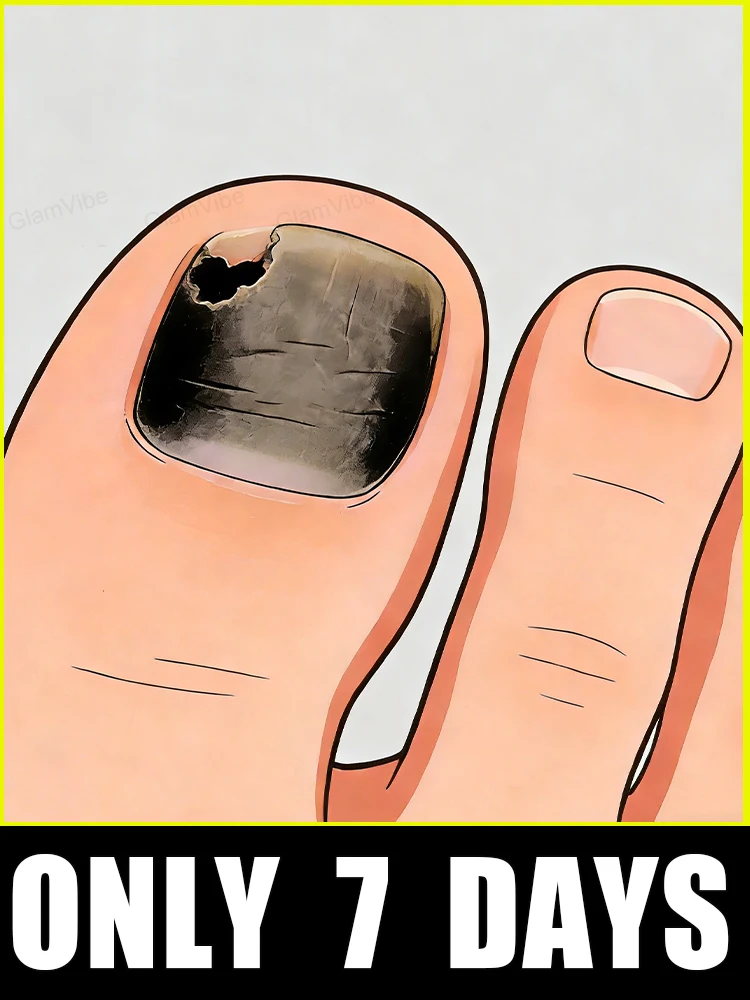 

Rapid penetrate, nails glassy-transparent,