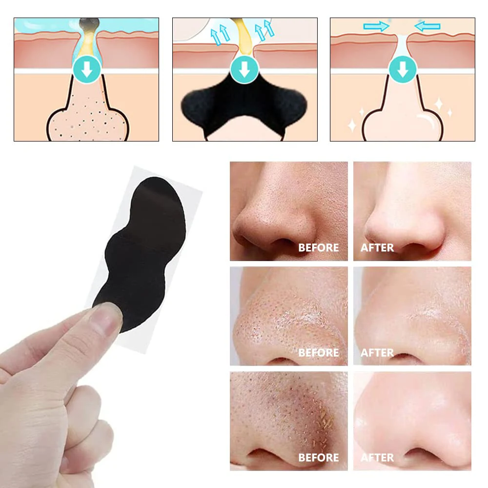 Nose Blackheads Pore Strips 10/20Pcs Skin Care Tools Deep Cleansing for Women Men Exfoliating Shrink Pore Acne Remover Strips