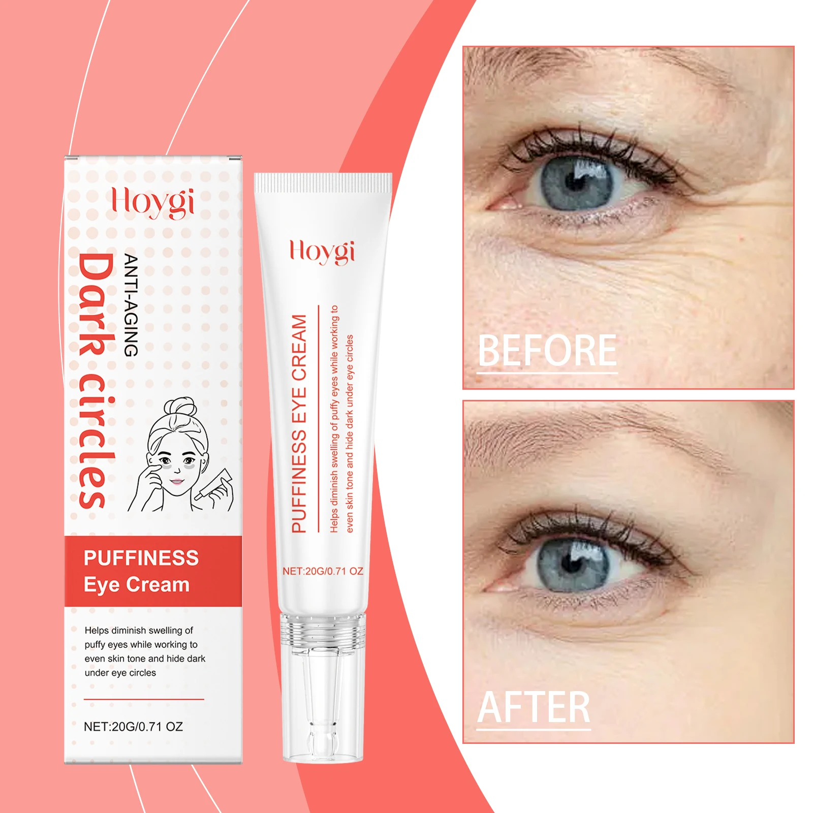 "파크 서클 퍼피니스 아이 크림 – 다크서클 & 언더 아이 트리트먼트, 데퍼핑 아이 크림 포 백, 브라이트닝 포뮬러, 20g