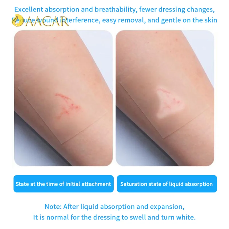 

1/5 Pcs Self-Adhesive Patches Hydrocolloid Dressing Invisibility Breathable Wound Plaster Band Aid Adhesive Bandages Skin Tape