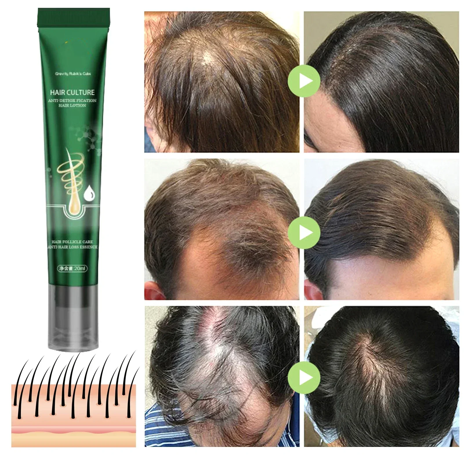 Hair Growth Oil Effective Repair Scalp Tissue Treatment and Prevention of Hair Loss Keratin Hair Treatment for Men and Women