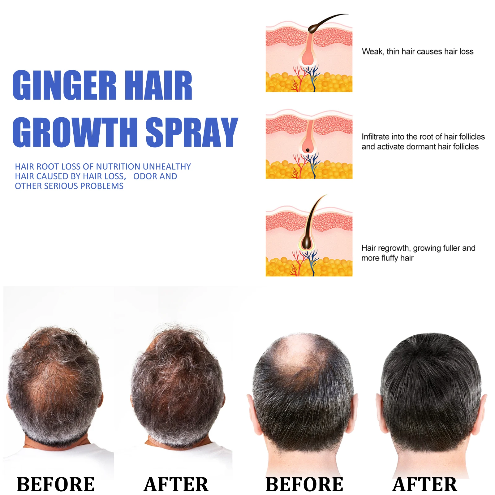 Fast Ginger Hair Growth Spray - Hair Care Hair Serum ulasan dan harga