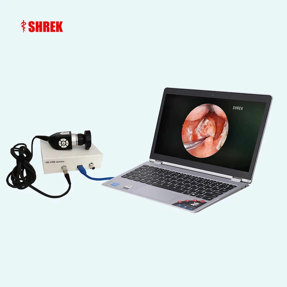 Video Otoscope Portable Usb Hd Veterinary Ent Endoscope