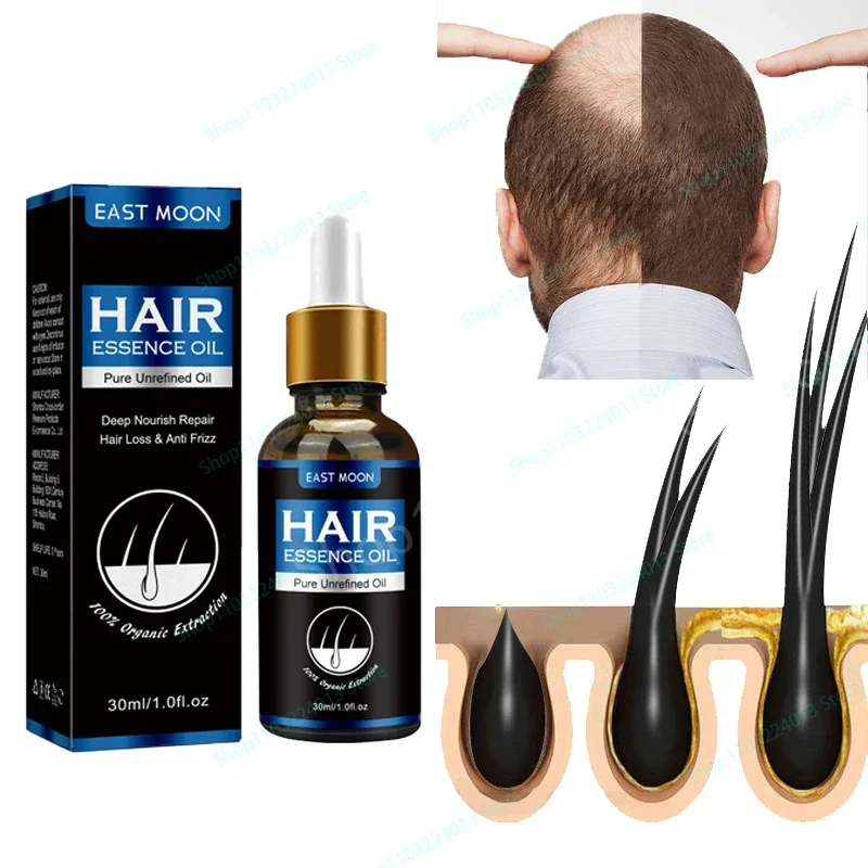 

Sdatter Fast Hair Growth for Men Women Hair Oil Care Ginger Anti Hair Loss Scalp Treatment Grow Serum Products Beauty Health