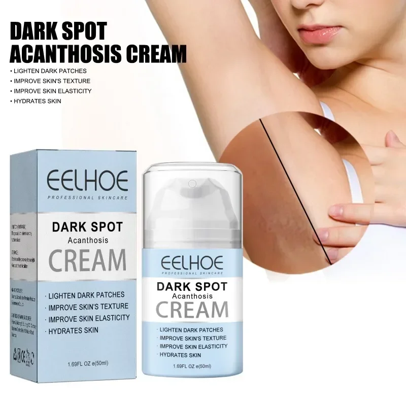 

Acanthosis Whitening Cream Underarm Knee joint Armpit Bleaching body Improve Dull Dark Spots removal Melanin Brighten Skin Care