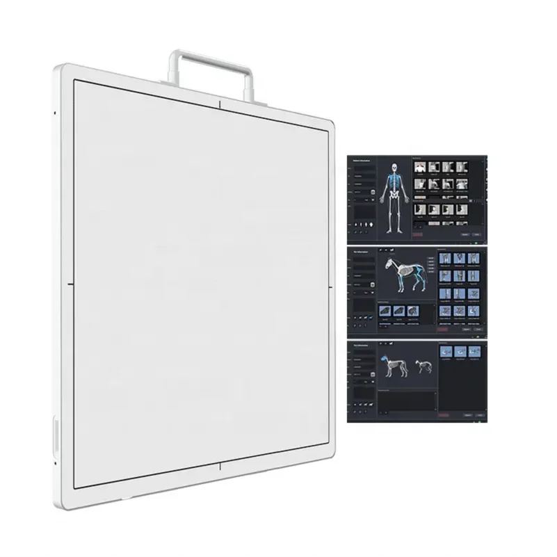 17*17 Inch Iray DR Wireless Flat Panel Detector Medical X Ray Equipment Wireless Digital X-ray Flat Panel Detector