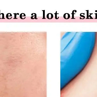 Dispositivo per massaggio di bellezza del viso Massaggiatore elettrico per la pulizia del viso Cura della pelle del viso Ringiovanimento della pelle Lifting Stringere multifunzionale