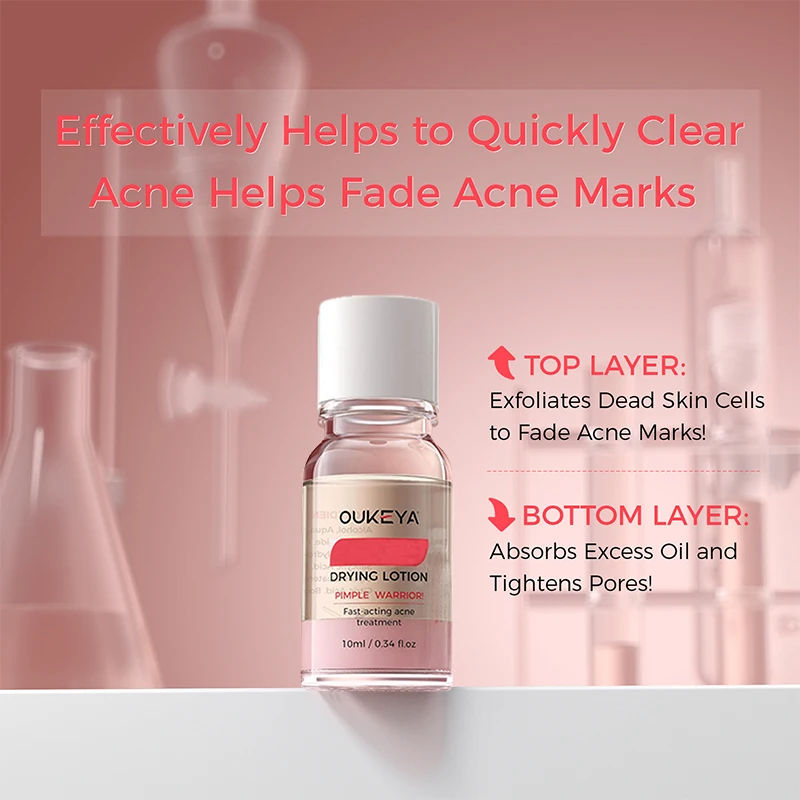 Anti-Acne Facial Repair Whitening Essence Shrinks Pores Moisturizes Controls Oil Removes Blackheads & Acne Deep Cleaning Pore