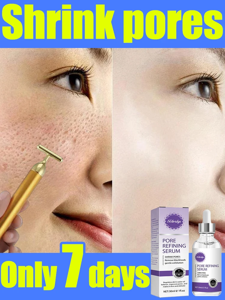 

open pores cream pore minimize serums