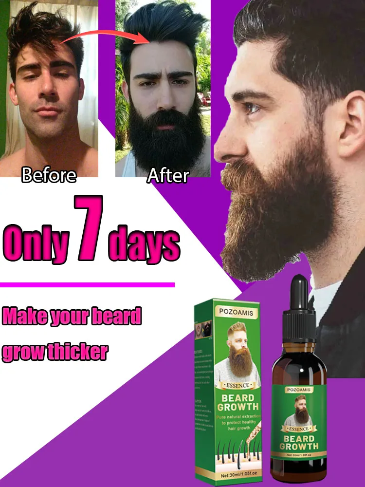 

Пробудите жизненную силу бороды и начните быстро ее отращивать за 7 дней