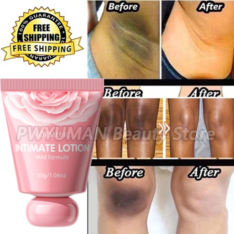 كريم تبييض الأجزاء الخاصة تحت الإبط لوشن تبييض تبييض بعقب الركبة سطع الفخذ الداخلي الأجزاء الحميمة إزالة الميلانين الداكنة #2