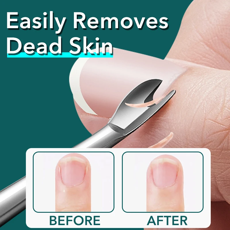 1Pcs เล็บศิลปะ Pusher Dead Skin Remover Stick Rod เจลสแตนเลสแหนบเล็บตัดเล็บ Nail Art Face skin Care เครื่องมือ