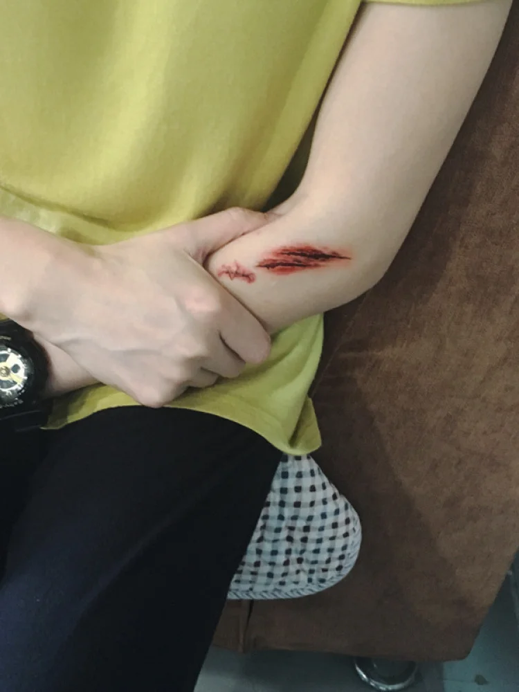 Tatuaje impermeable Stiers loween Par herida Reatic mancha de sangre cicatriz broma Stiers aguja costura aspecto auténtico