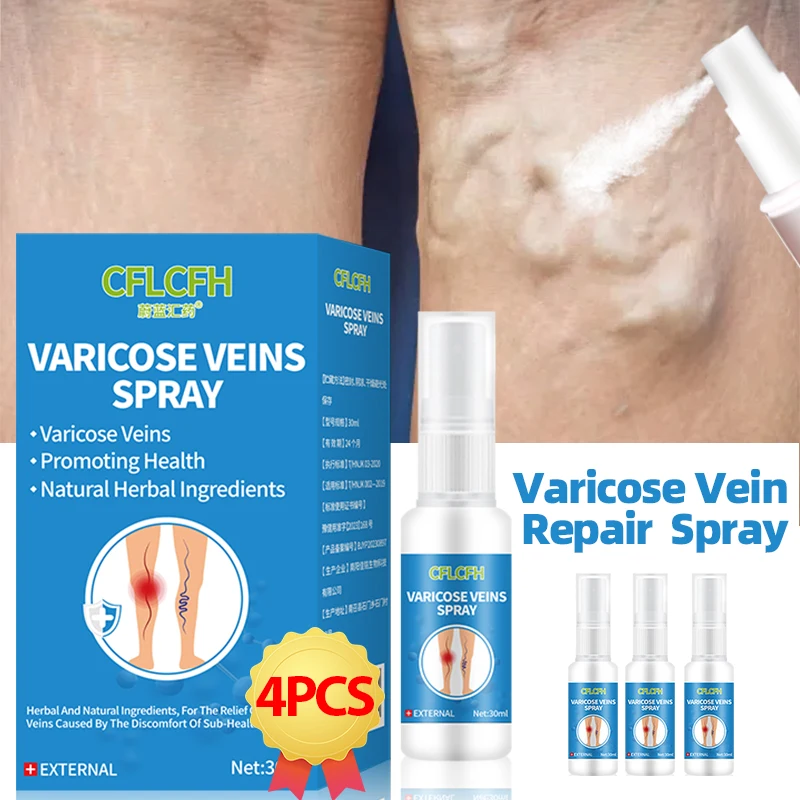 Varicose Veins Spray Vasculitis Phlebitis Varicosity Treatment Medicine Liquid Spider Legs Angiitis Relief Leg Dilated Foot Care