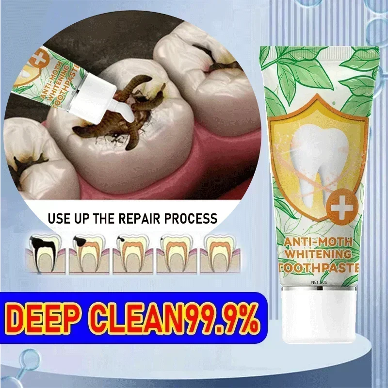 

Teeth Whitening Remove Dental Caries Dental Calculus Tooth Decay