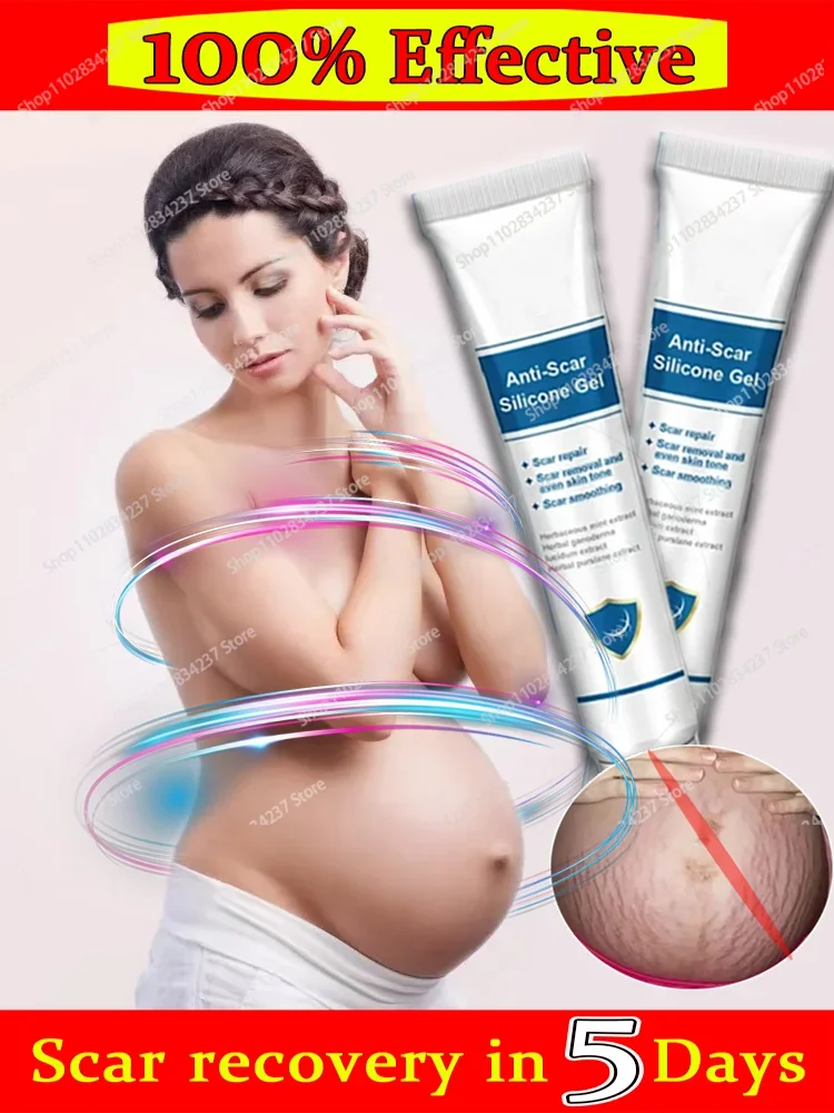 

Eliminate Stretch Marks Fade Obesity Tattoos Body Skin Care For Pregnant Women