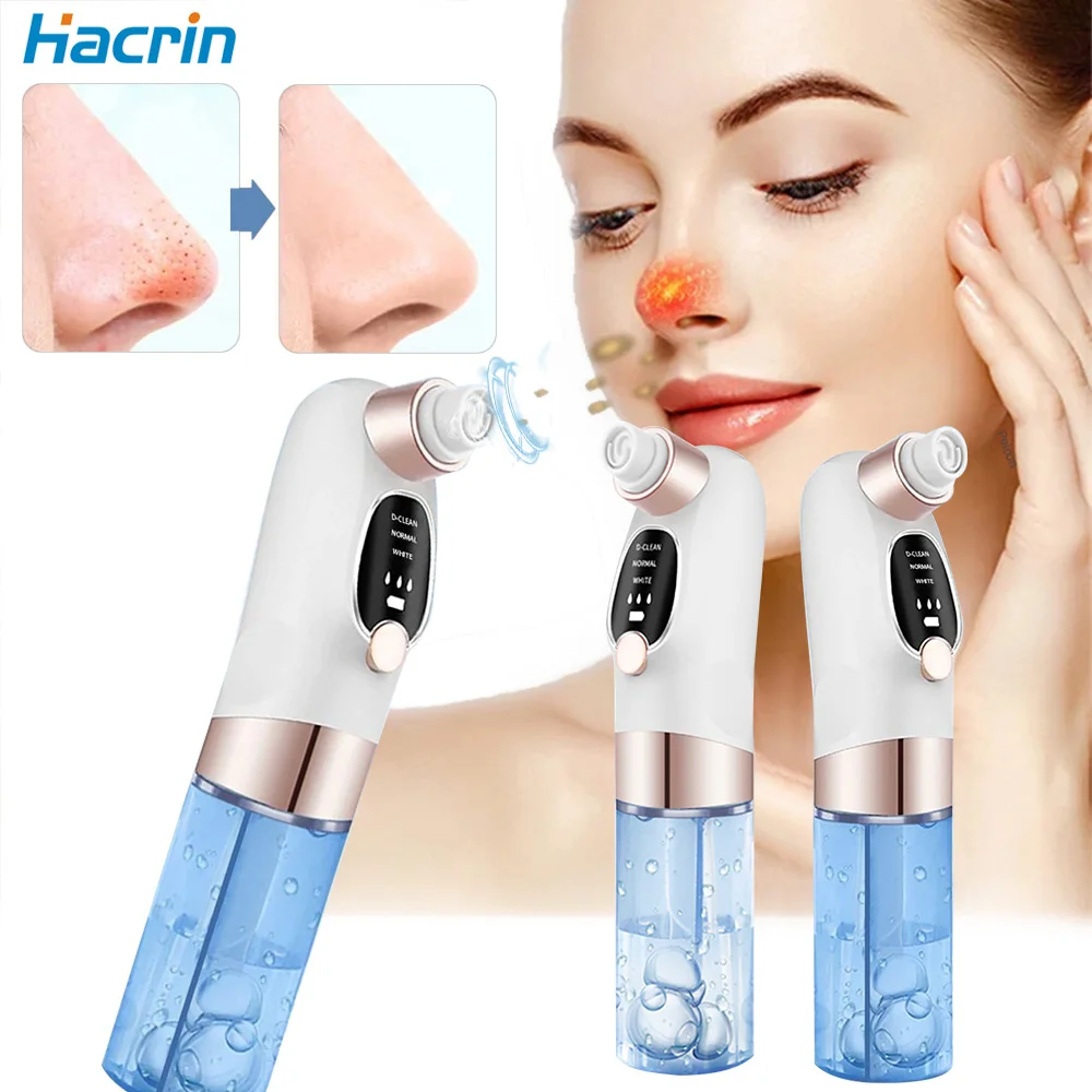 

Электрический пылесос для удаления черных точек, устройство для очищения пор, маленькие пузырьки от акне, экстрактор черных точек, удаление черных точек