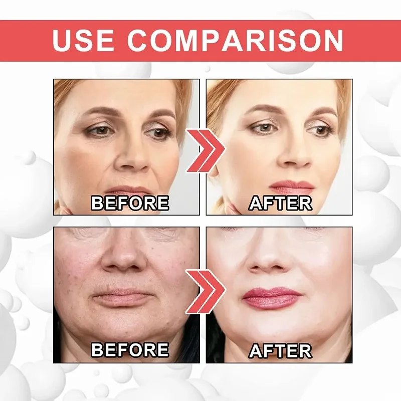 Women's Collagen Enhancement Cream Brightens Skin Tone Lightens Facial Lines Facial Rejuvenation Essence Cream Skin Care