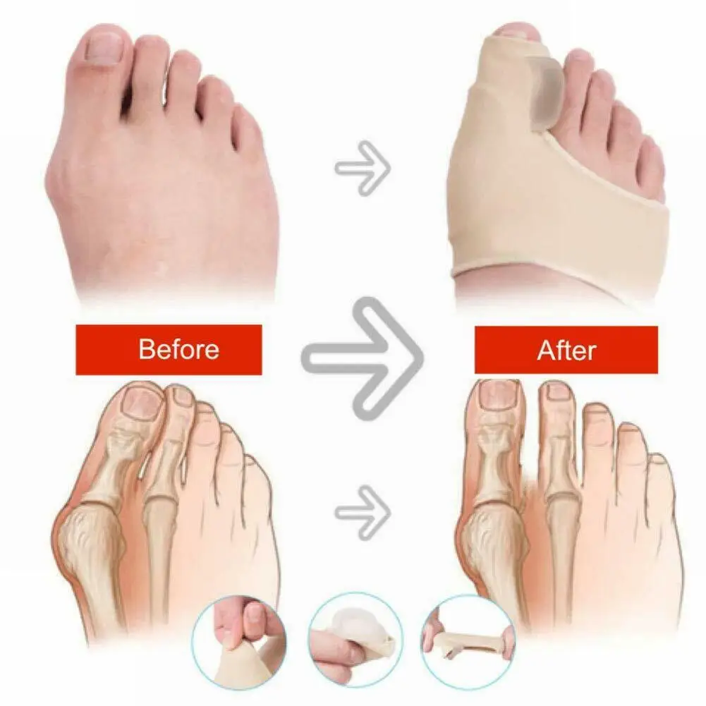 Nail Care Toe Corrector Hallux Valgus Corrector Flexible Fabric 2Pcs Big Toe Bunion Pad Fabric Gel Straightener