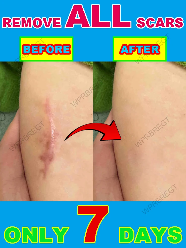 

Лечит и обновляет, естественно