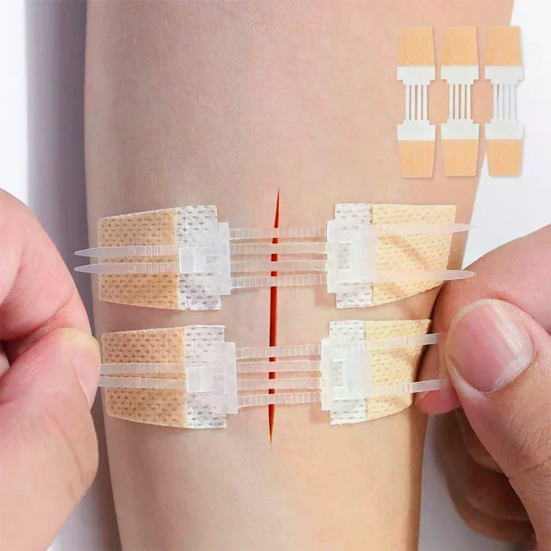 Zipper Band-aid Painless Wound Closure Patch Suture-free Wound Dressing Patches Zip Suture Reducer Band Aid Outdoor Portable