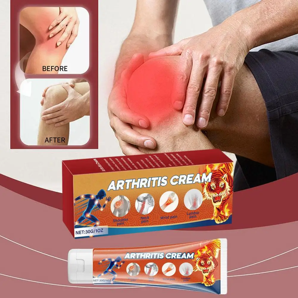 Crème contre l'arthrite pour les articulations, crème contre l'arthrite, crème contre l'arthrite, force maximale pour oto dans le dos, cadeaux de festival JoendocKnees, 30g