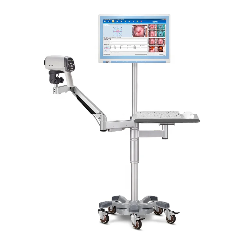 EDAN Swing Arm Stand Full Set with Keyboard Tray Video Colposcopy C6A HD for Gynecology