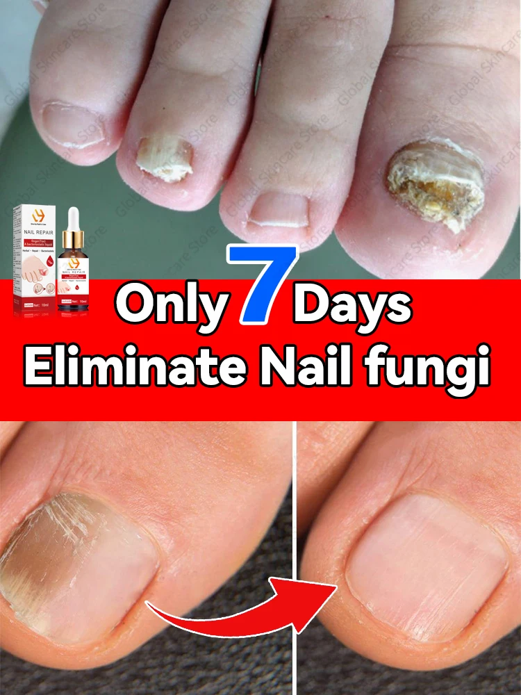 Solves all nail problems