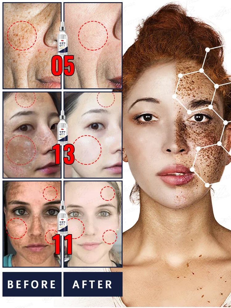 肌の色ムラを効果的に除去し、完璧な肌を取り戻します