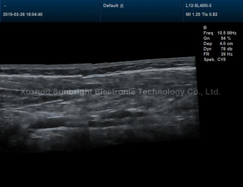 Sunbright ultrasound sun 906A 3d ecografo 4d color doppler ultrasound price