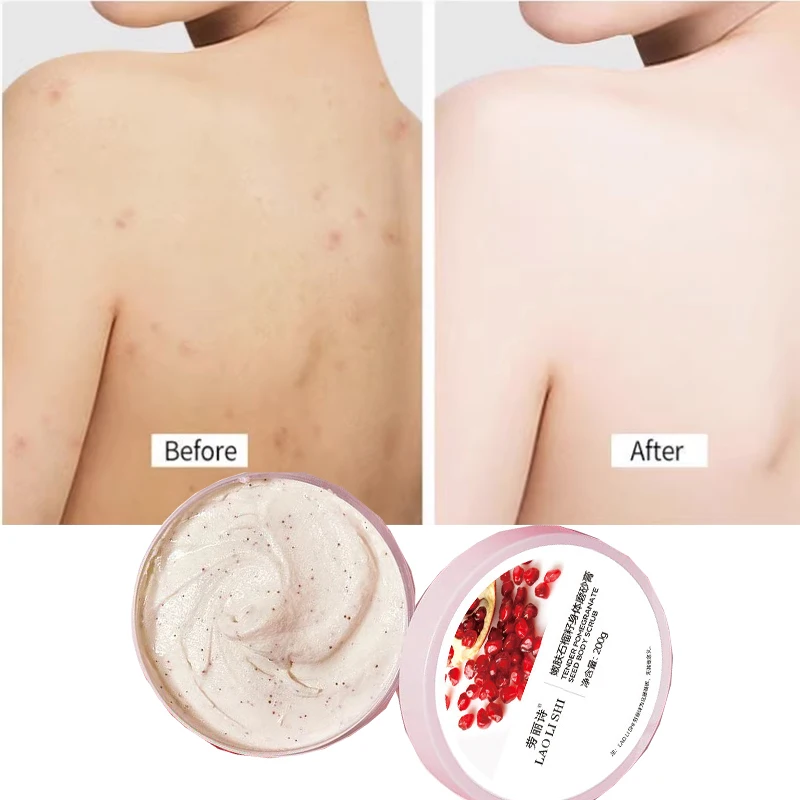 Pomegranate Seed Scrub Cream exfoliates chicken skin Moisturizes the whole body Deeply cleanses Brighten skin tone rubs mud