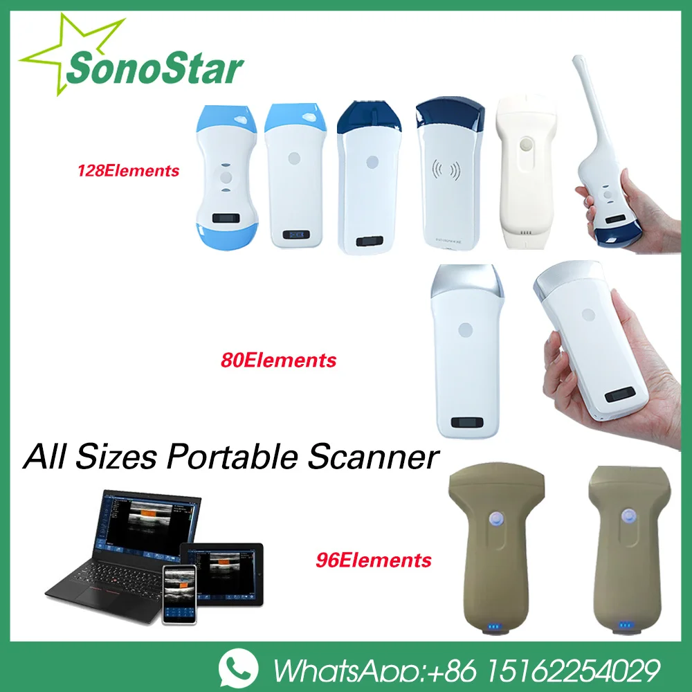 

Sonostar Brand Factory Портативный беспроводной ультразвуковой зонд сканер портативный аппарат WIFI ультразвуковой сканер машина