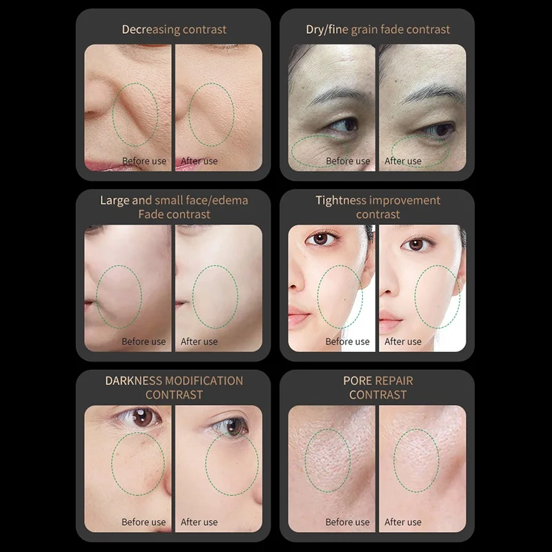 แสงสีแดง Collagen Regenerator Anti-Aging RF Anti-Wrinkle อุปกรณ์ความงาม EMS Microcurrent กระชับผิว Face Lifting Massager