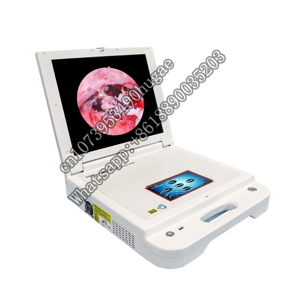 medical portable hd 1080p system with light source for urology equipment cystoscopy surgery