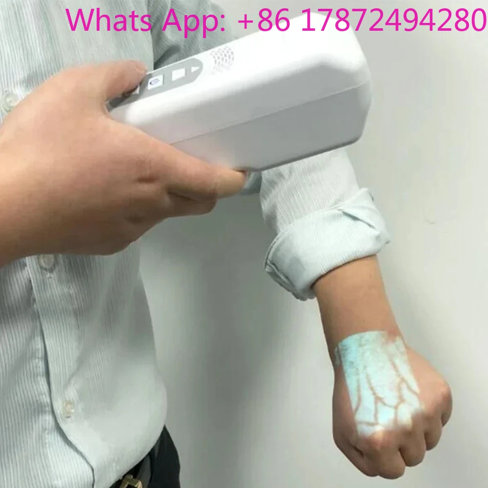 

Handheld Portable Vein Finder FOR SALE, LTOV01 NEW Cheap price