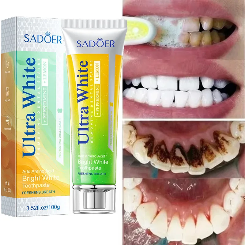 Whitening Toothpaste Dental Calculus Remover Bad Breath Removal Teeth Toothpaste Brightening Fresh Breath Dental Cleansing Care