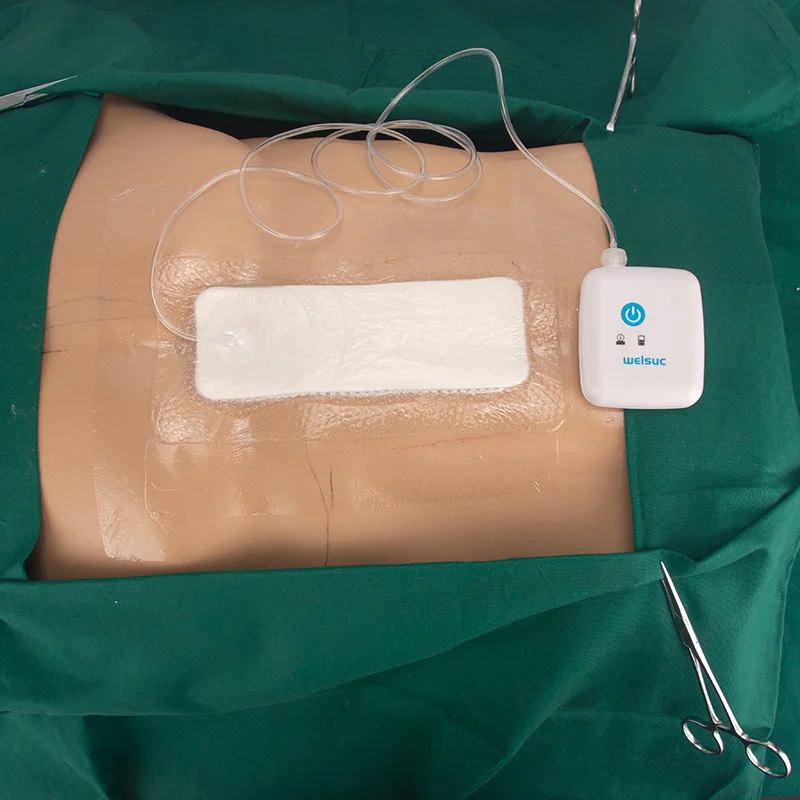 unique Negative Pressure Wound Therapy System Device NPWT Machine NPWT Unit Dressings Wound Vac Drainage System