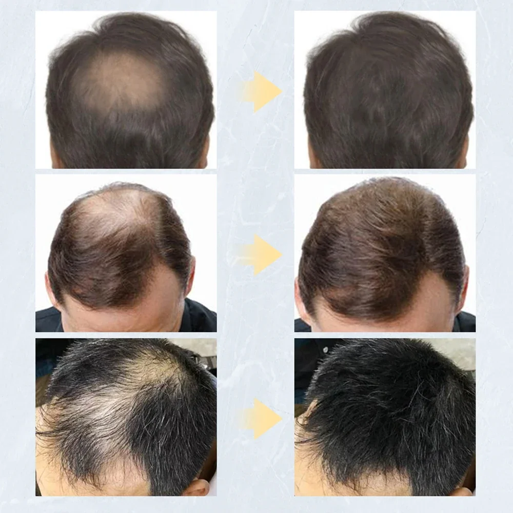 Queratina Fibers Spray para Construção Capilar, Pós de Rebrota Instantânea, Hair Loss Conceale, 8 cores, 27,5g