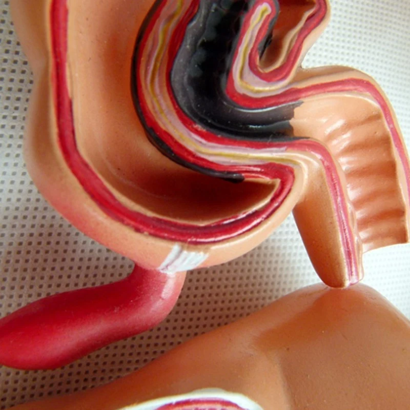 Teaching Model,Human Large Intestine Anatomy Model Visceral Lesion Model Human Digestive System Learning Model Durable