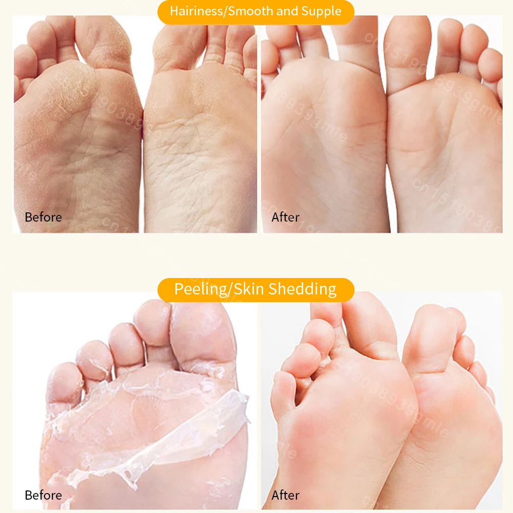 Horse Oil Foot Cream Removal Dead Skin Foot Care Moisturizing Cream Repair Horse Oil Anti-Drying Callus Easy To Carry for Travel