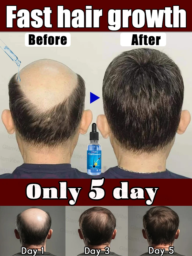 WPRBREGT blue bottle.hair growth essential 0iI. Say goodbye to baIdness. The secret 0f thick hair