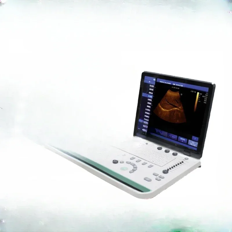 

B-ultrasound entry-level portable medical SS-8 for pregnant women