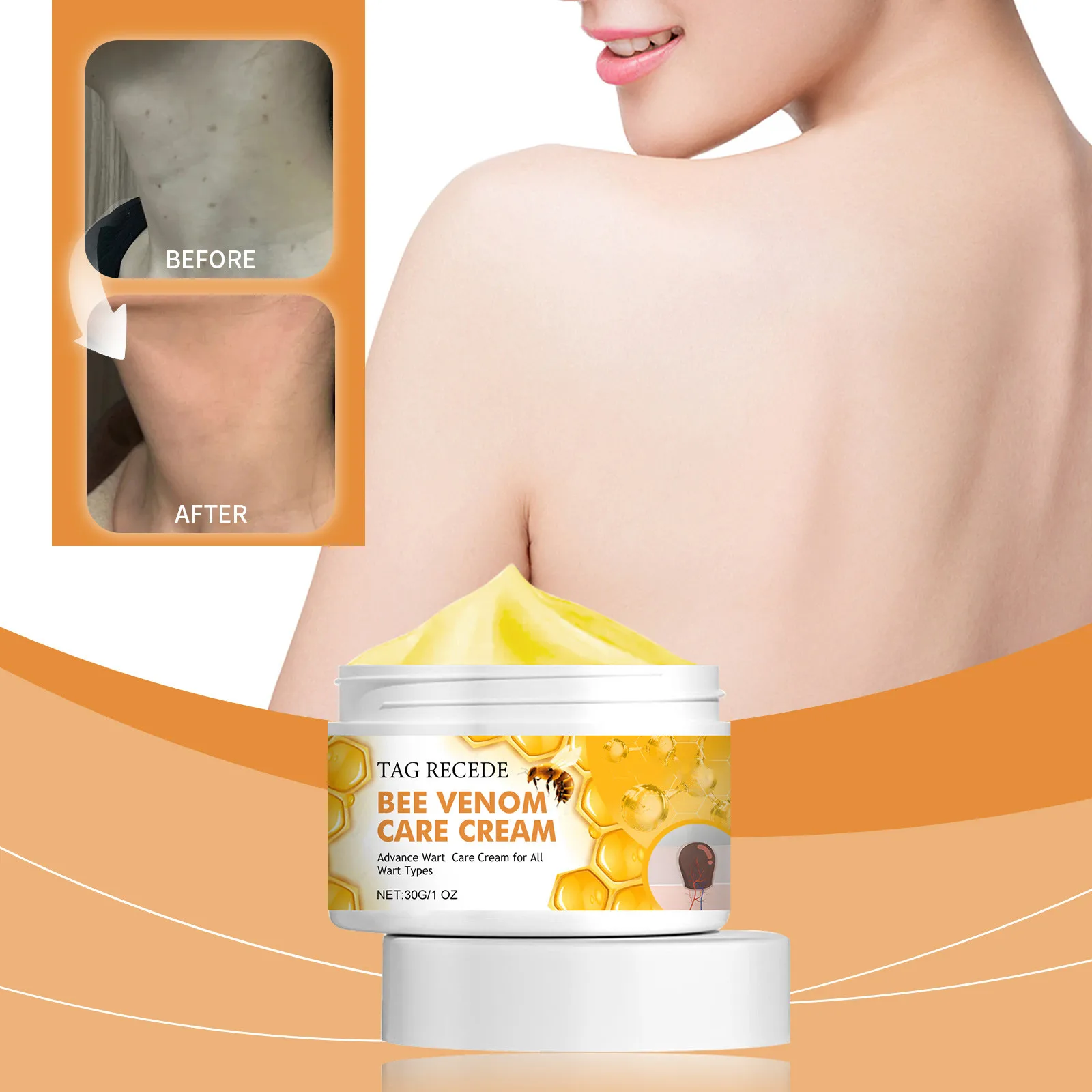 30g Bee Venoms Joint Care Cream Relieve Cervical Joint Soreness Massage Treatments Cream Bone Health Body Care Tools