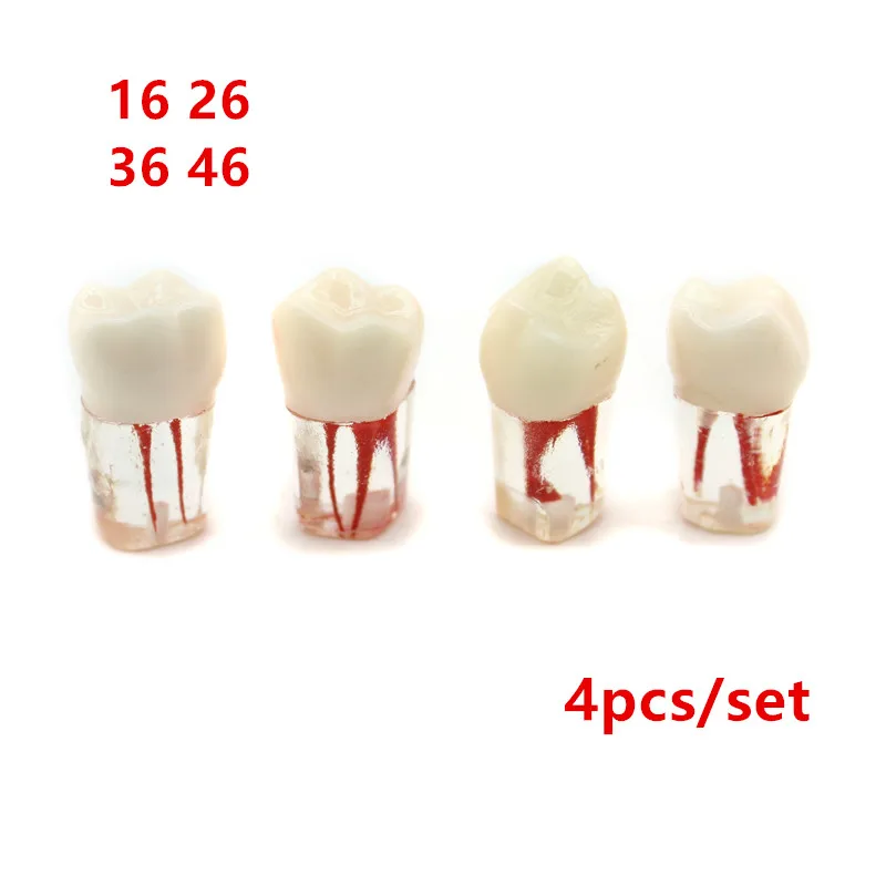 

4Pc Dental Tooth Model Root Canal Block RCT Practice Pulp Cavity Dentistry Replace Resin Teeth Endo Training Student