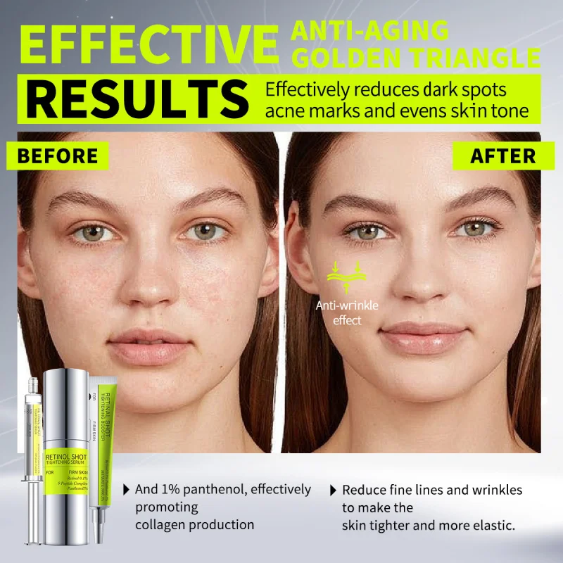 

Укрепляющий увлажняющий крем для глаз с ретинолом, нежная подтягивающая сыворотка с ретинолом для области вокруг глаз, восстанавливающий ежедневный уход